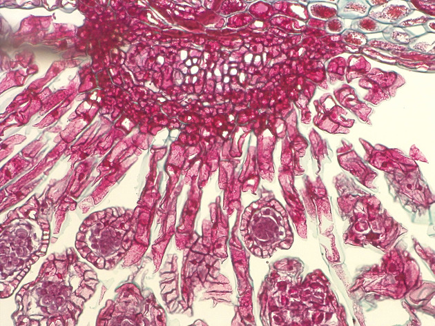 Mature Sporangia Slides - Mature Sporangia 03 200X